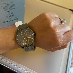 Large face skagen watch